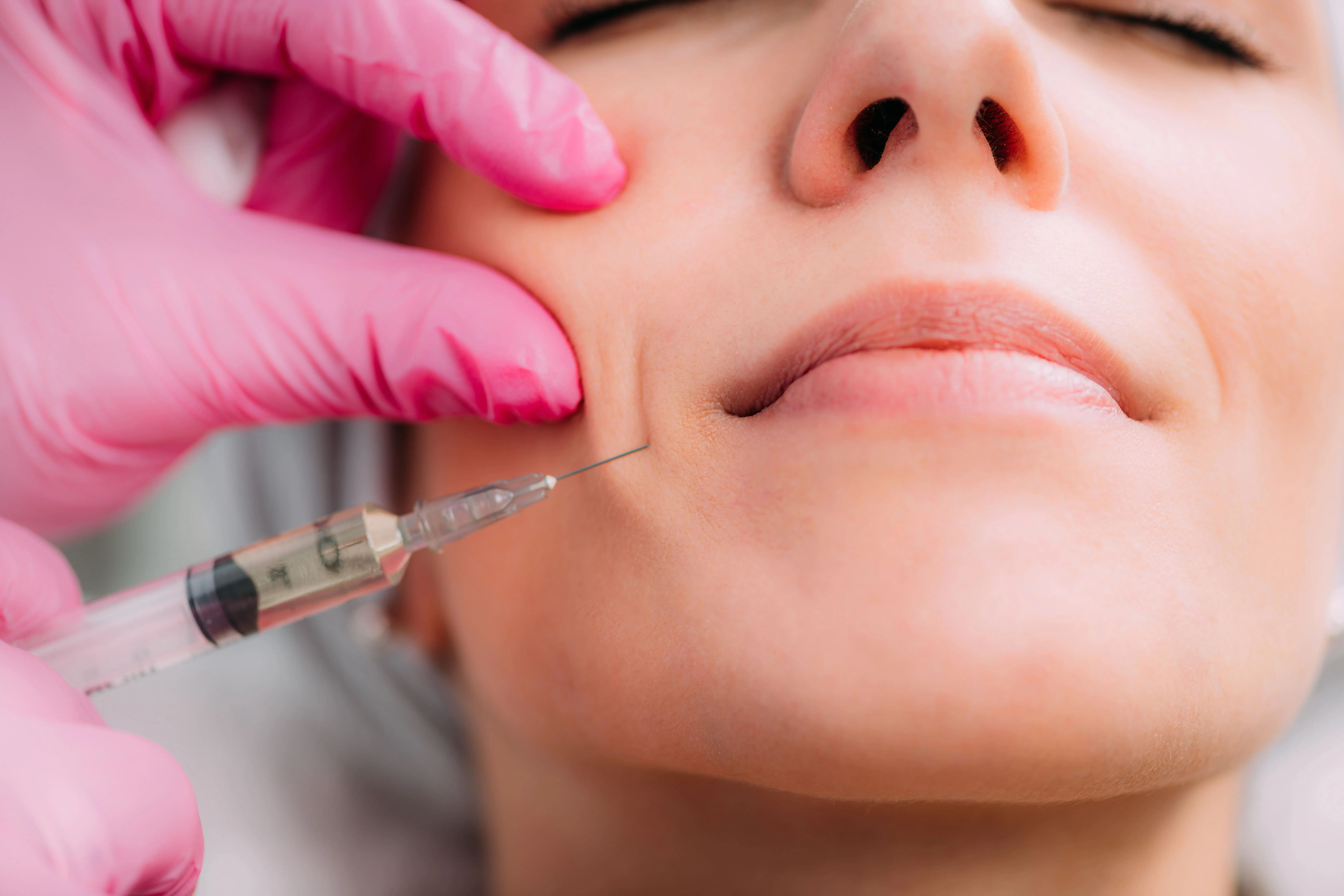 Dermal Fillers by Century Medical Services